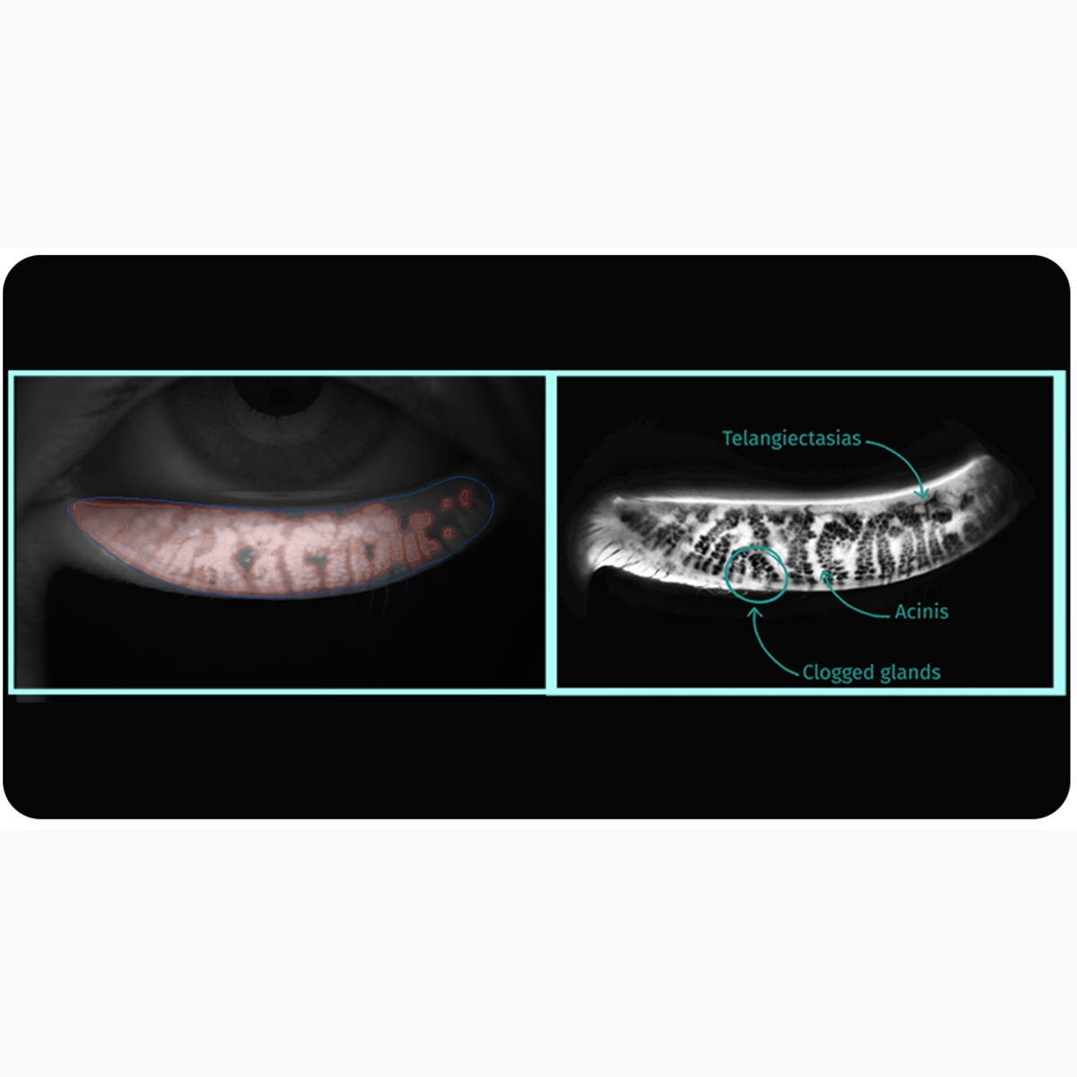 Produktfoto Quantel Medical C.Diag